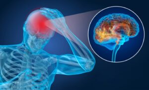 Cerebral Contusion vs. Concussion
